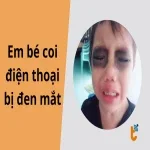 Em bé coi điện thoại bị đen mắt - Xem ngay cách bảo vệ mắt cho bé!