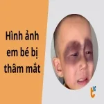 Hình ảnh em bé bị thâm mắt troll cực hài để trêu đùa