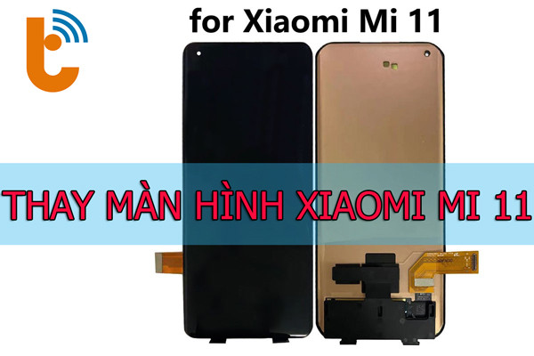 Thay màn hình Xiaomi Mi 11, Mi 11 Lite