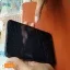 xiaomi-redmi-7-bi-nut-vo-mat-kinh-gay-nguy-hiem-cho-nguoi-dung-khi-su-dung